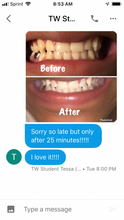 Load image into Gallery viewer, Teeth Whitening
